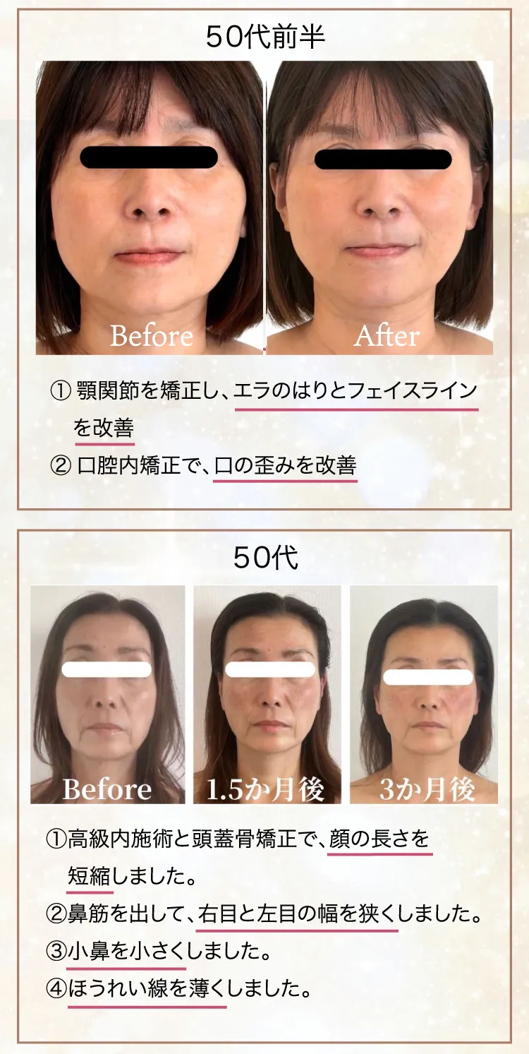 たるみほうれい線専門サロンDr.Body大宮