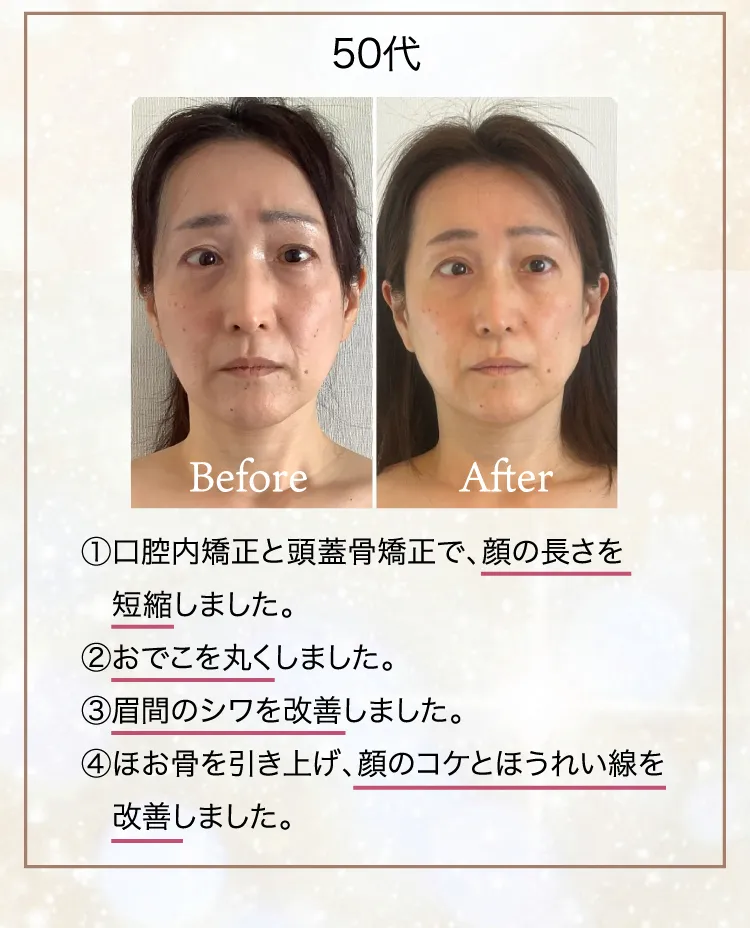 たるみほうれい線専門サロンDr.Body大宮