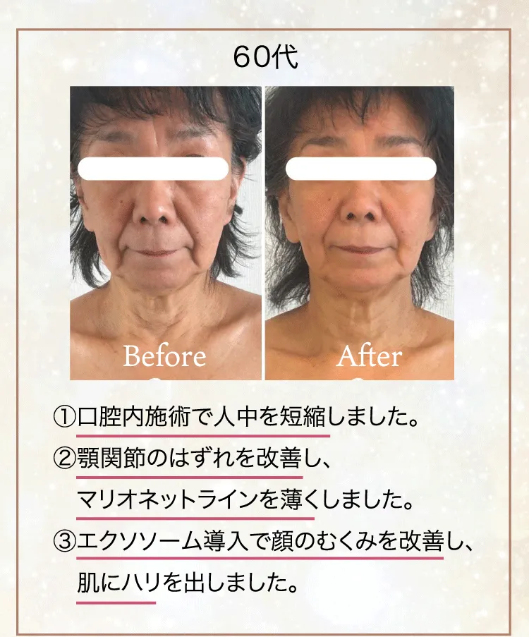 整形級小顔サロンRaku-E