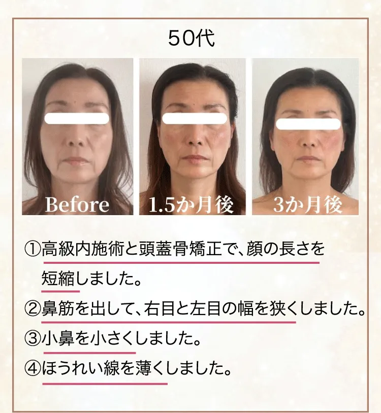 整形級小顔サロンRaku-E
