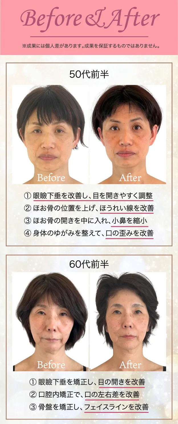 たるみほうれい線専門サロンDr.Body