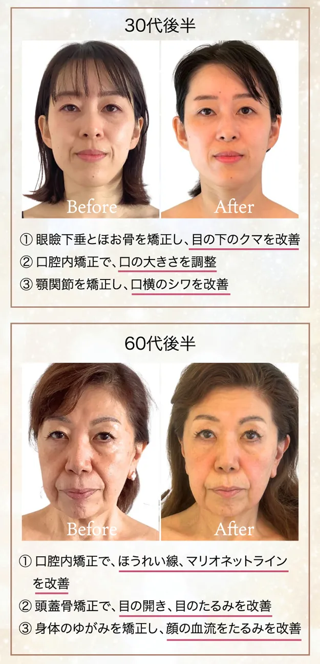 たるみほうれい線専門サロンDr.Body