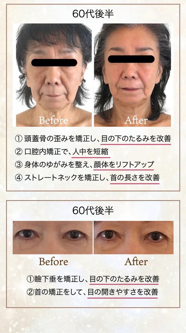 たるみほうれい線専門サロンDr.Body大宮